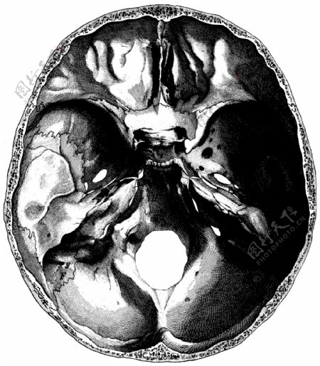 人体头盖骨切片内部CT图片