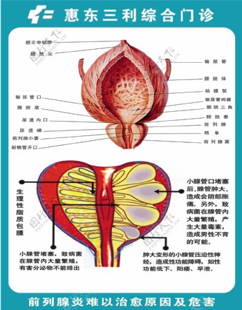 前列腺圖片