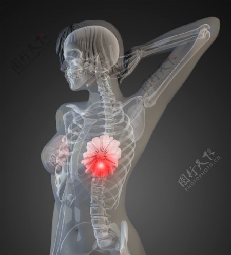 女性胸部X光透视图图片