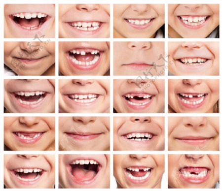 儿童牙齿保健图片