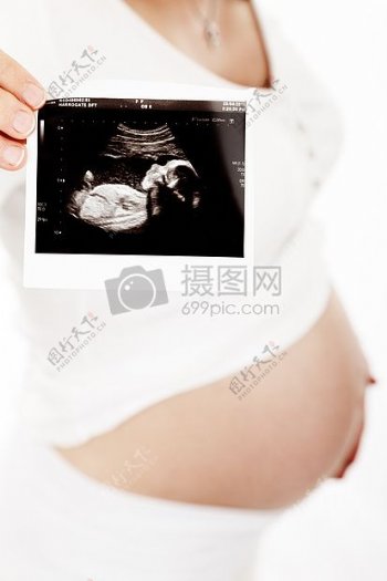 孕妇手拿宝宝B超照片