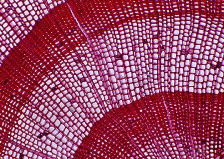紫红色细网状细胞结晶