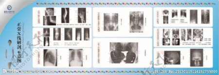 正常X线解剖示意图图片