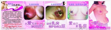 乳腺癌预防展板图片