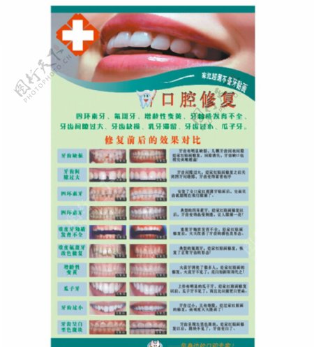 诊所医院宣传牌牙齿牙科牙齿修复图片