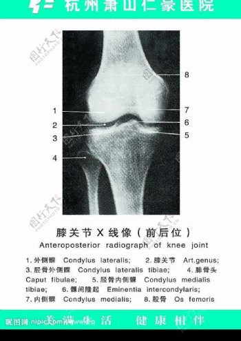 膝关节X线像图片