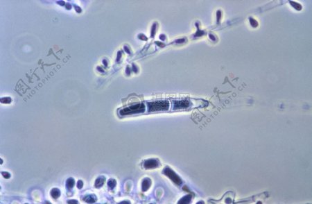 显微镜下的微生物