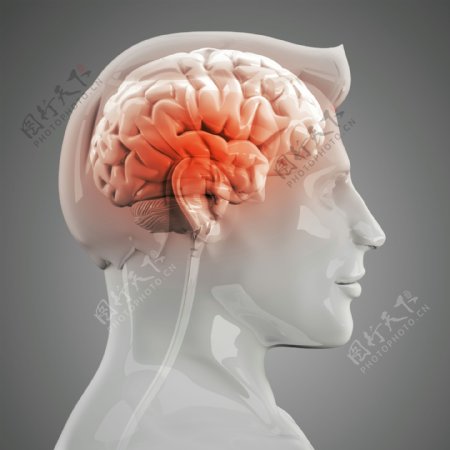人体左脑X光图像图片