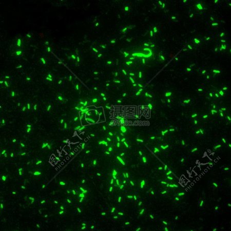 鼠疫耶尔森氏菌直接荧光抗体染色DFA放大40倍