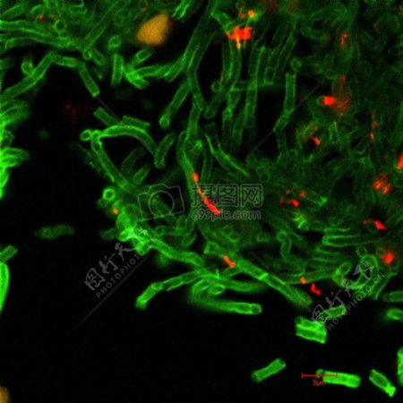 炭疽杆菌的共焦显微照片